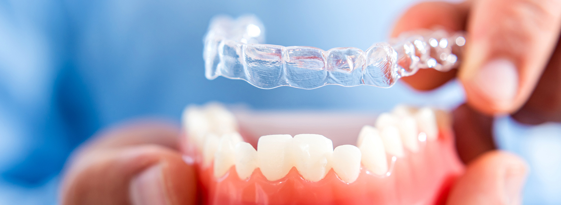 Invisalign aligners at our Waterdown dental clinic.