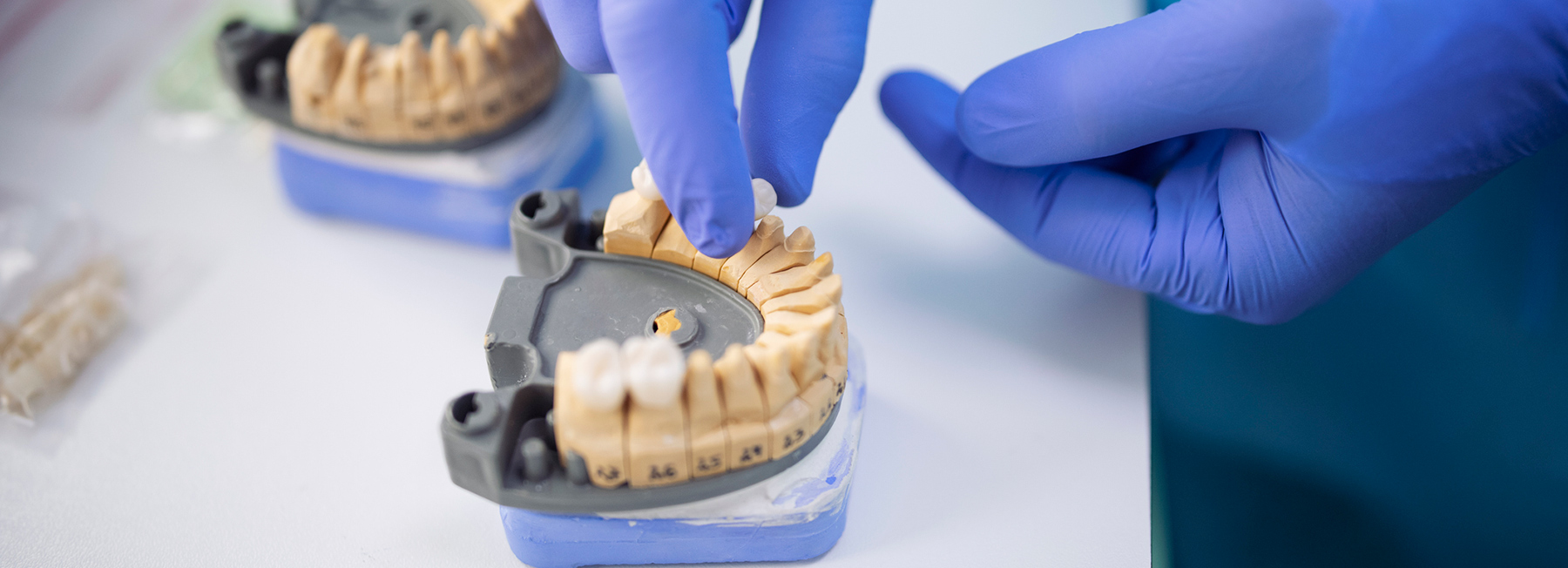 We provide a wide array of dental services and treatments, including dental crowns.